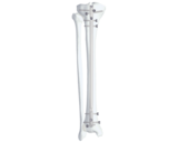 II型脛骨髓內釘